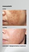 Melan Tran3x Concentrate